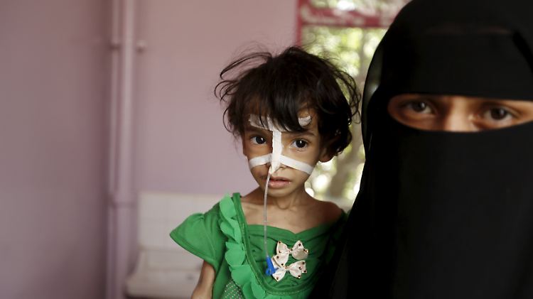 Eine Mutter und ihre unterernährte Tochter in einem Krankenhaus in Sanaa. 