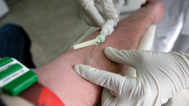 Bisher musste man drei Monate warten, bevor man sich auf HIV testen lassen konnte.
