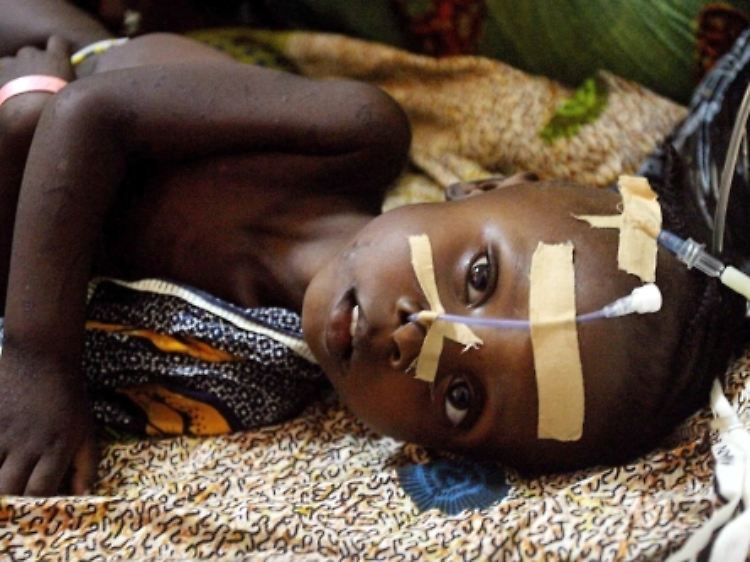 Der Hunger hat viele Gesichter: Unterernährung führt nicht nur zu körperlichen Leiden, sondern kann auch geistige Behinderungen und Traumata hervorrufen.