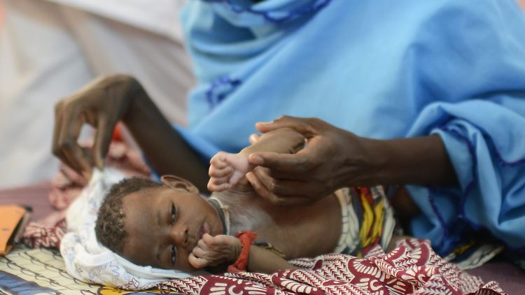 Ein unterernährtes Kind in Senegal. Das größte Risiko zu sterben besteht für Kinder aus Angola.