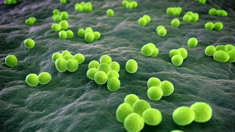 MRSA ist der bekannteste Krankenhauskeim. Hinter dem Kürzel verbergen sich Bakterien der Art Staphylococcus aureus. Sie sind gegen Antibiotika wie Methicillin resistent geworden.
