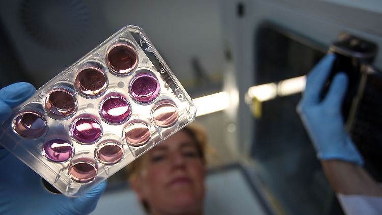 Die Niere, die Forscher aus Stammzellen gewonnen haben, ähnelt von den Zelltypen her der eines Embryos.
