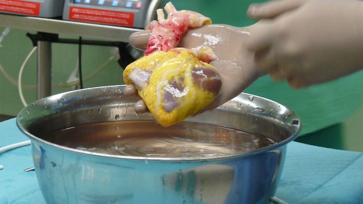 Gegenwärtig kommen in Deutschland etwa zehn Organspender auf eine Million Einwohner.