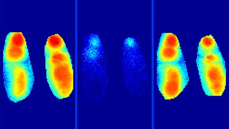 Die langsamen Wellen im Hirn von Mäusen während des Schlafes (l), Gestörter Prozess durch Alzheimerplaques (m), langsame Wellen nach der Gabe eines Benzodiazepins (r).