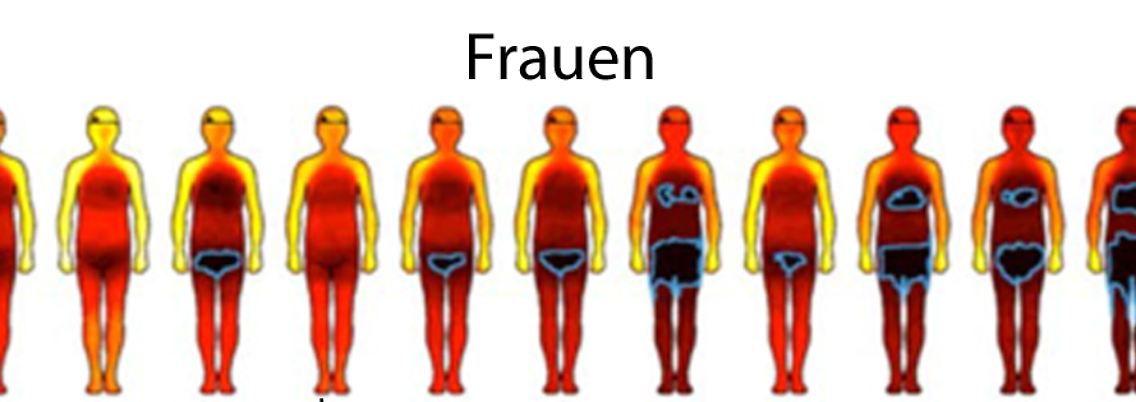 Körperzonen.JPG