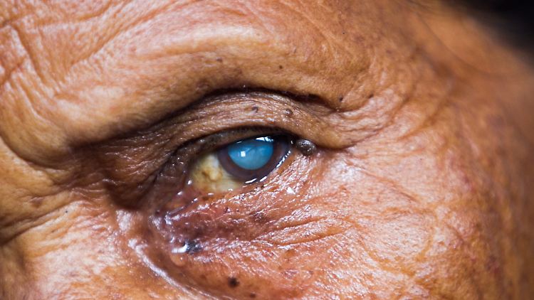 Der neu entdeckte Wirkstoff könnte vor allem Menschen in Entwicklungsländern helfen.