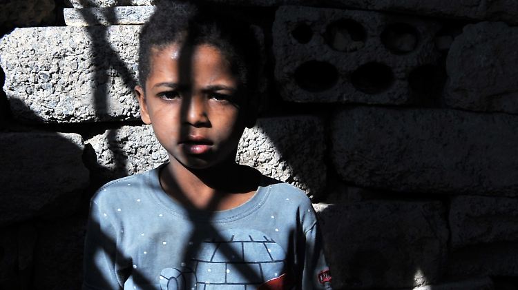 Wie in jedem Krieg sind es auch im Jemen die Kinder, die am meisten zu leiden haben.