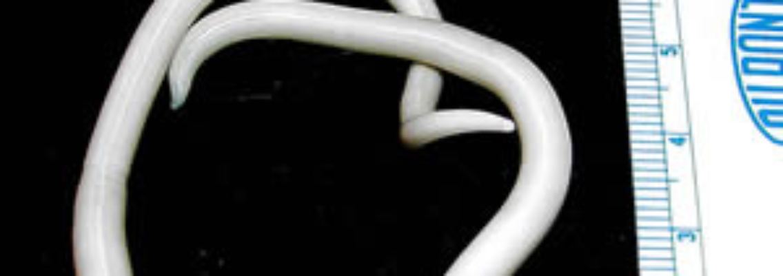 Ascaris_lumbricoides.jpeg