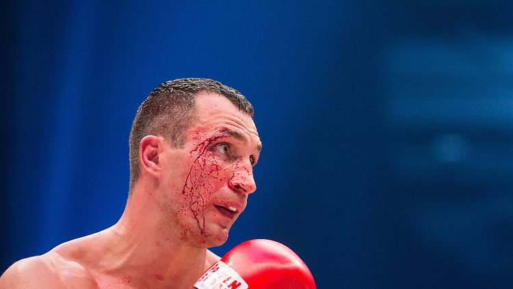 "Fury krönt sich auf einem Thron voller Blut", kommentierte die "Sun" die sensationelle Niederlage von Wladimir Klitschko und den Verlust seiner drei WM-Gürtel im Schwergewicht.