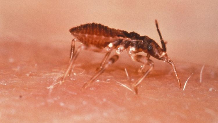Sie wird die "küssende Wanze" genannt: Raubwanzen, die Chagas übertragen können, beißen den Menschen an Mund und Augen.