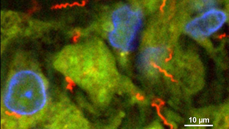 Treponema pallidum, der Erreger der Syphilis, ist bis heute nicht im Labor kultivierbar. Die Arbeitsgruppe Moter identifiziert diese Bakterien mit der molekularbiologischen Färbemethode FISH (Fluoreszenz in situ Hybridisierung). FISH mit einer T. pallidum spezifischen Sonde zeigt die Spiralbakterien (rot) im Gewebe (grün), Zellkerne (blau).