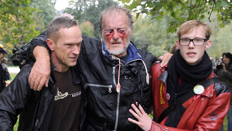 Ein Foto das um die Welt ging: Dietrich Wagner blutet aus beiden Augen nach dem überharten Polizeieinsatz. 