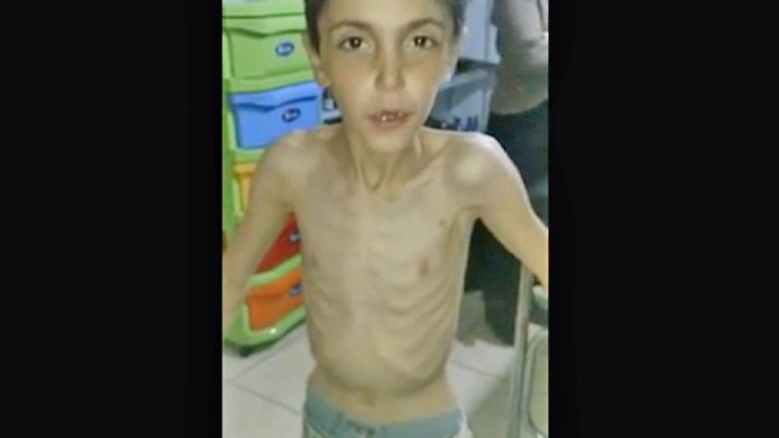Syrien_Madaja_Hunger_Not.jpg