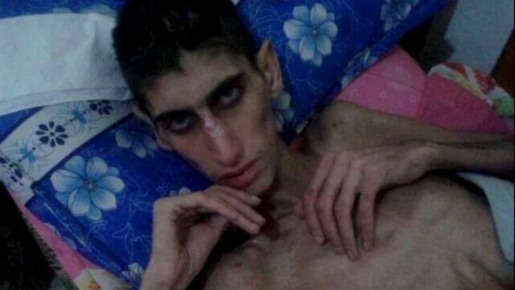 Dieses über soziale Medien verbreitete Foto soll einen völlig abgemagerten jungen Mann in Madaja zeigen.