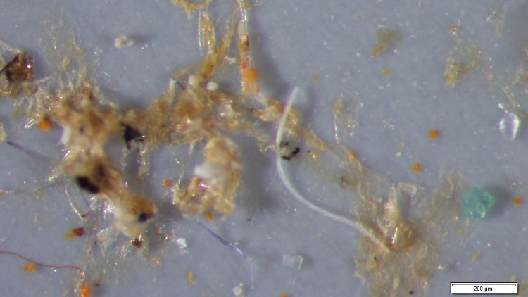 Schlucken Fische schonmal mit: winzig kleine Kunststoffteilchen, die im Meer schwimmen.