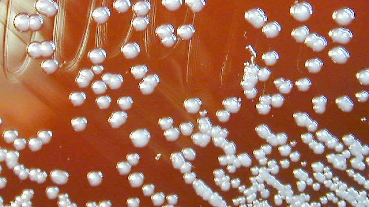 Burkholderia pseudomallei auf einer Agarplatte in einer Petrischale.
