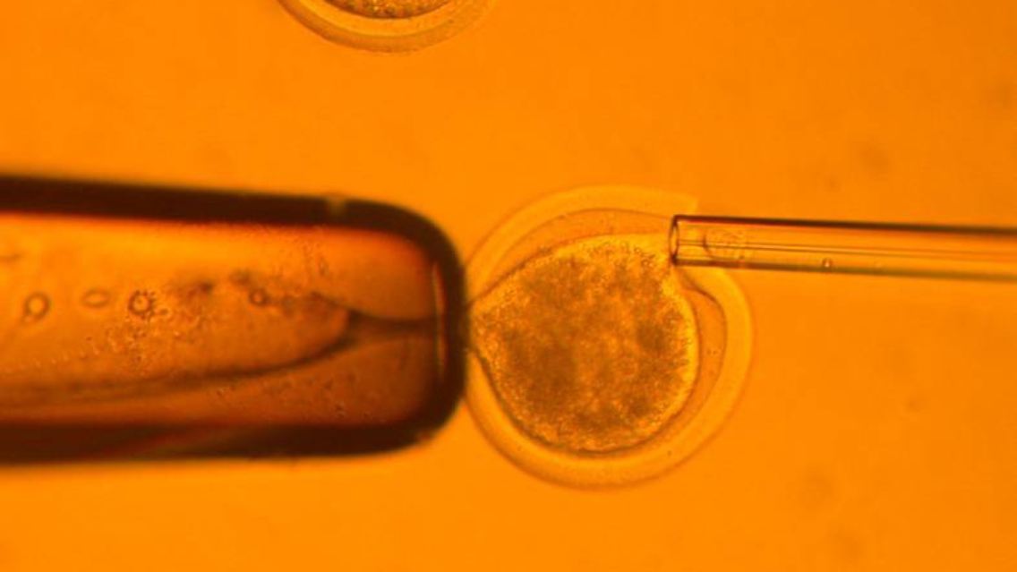 Durch die Methode des so genannten therapeutischen Klonens hoffen Wissenschaftler in aller Welt Stammzellen gewinnen zu können, die zur Heilung schwer kranker Menschen eingesetzt werden können.