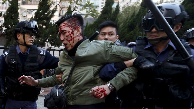 Zahlreiche Polizisten, aber auch Protestierende wurden bei den Krawallen in Hongkong verletzt.