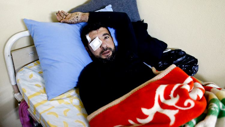 Dieser syrische Flüchtling wird in einem Krankenhaus im türkischen Kilis behandelt.