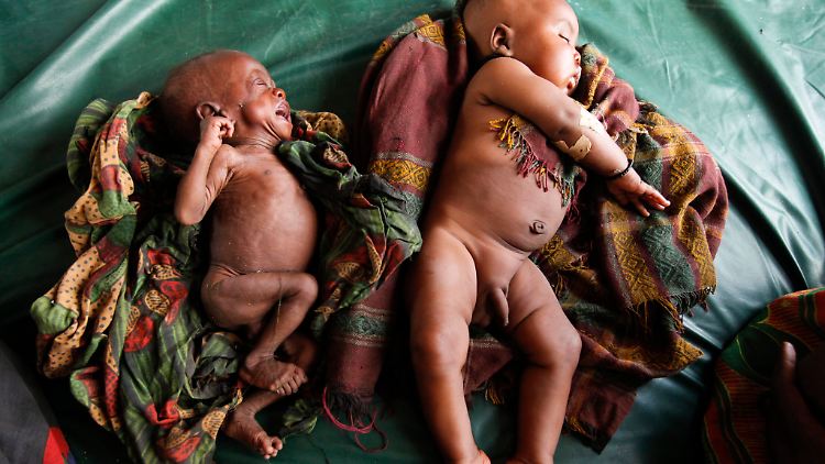 165 Millionen Kinder leiden an einer Mangelernährung. 