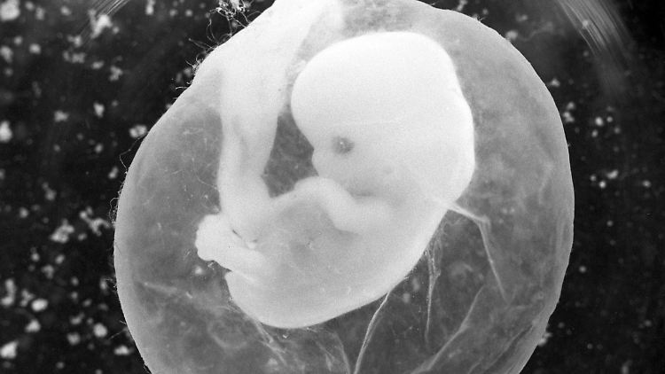 Infiziert sich eine werdende Mutter während der Schwangerschaft mit Toxoplasmose, kann das Kind in Gefahr sein.