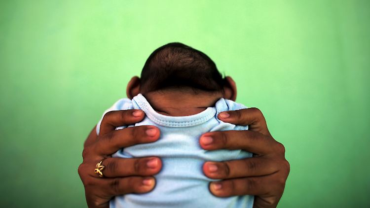 Das Zika-Virus steht im Verdacht, bei Ungeborenen die Mikrozephalie auszulösen. 