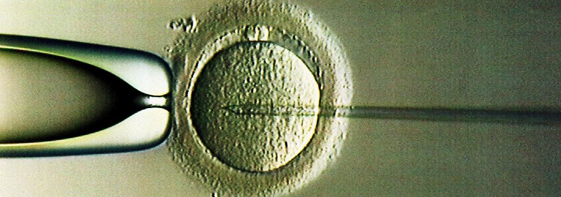 Das Bild zeigt eine künstliche Befruchtung nach der ICSI-Methode - ICSI steht für Intra-Cytoplasmatische Sperma-Injektion. Dabei werden Spermien direkt in eine der Frau entnommenen Eizelle injiziert.