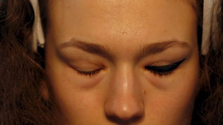 Auch Models haben manchmal verquollene Augen. 
