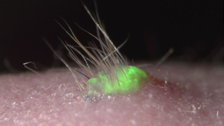 Forschern ist es gelungen, aus Stammzellen von Mäusen ein Hautstück mit Haaren und Talgdrüsen zu schaffen.