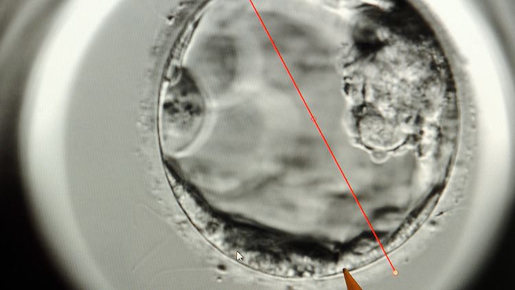 Foto aus einem deutschen Kinderwunschzentrum: Rechts von dem roten Markierungsstrich ist ein fünf Tage alter Embryo zu sehen, im unteren linken Bereich der werdende Mutterkuchen.