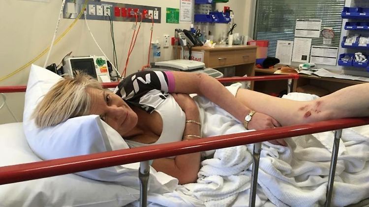 Die Australierin Sharon Heinrich liegt nach der Känguru-Attacke im Krankenhaus.