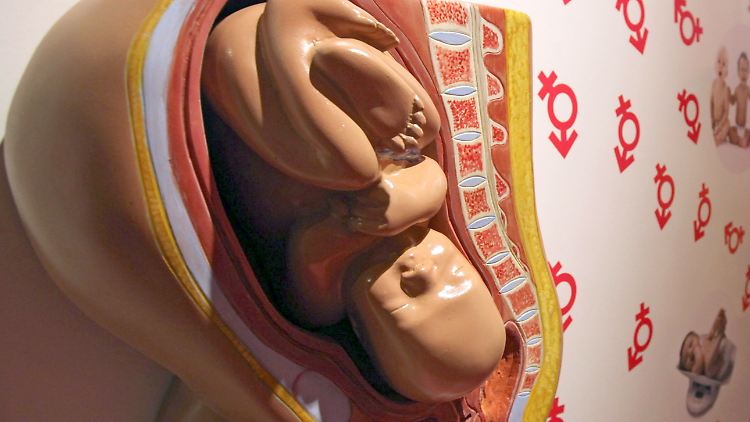 Profitieren können Frauen, deren Gebärmutter zu klein ist oder die keine Gebärmutter haben.