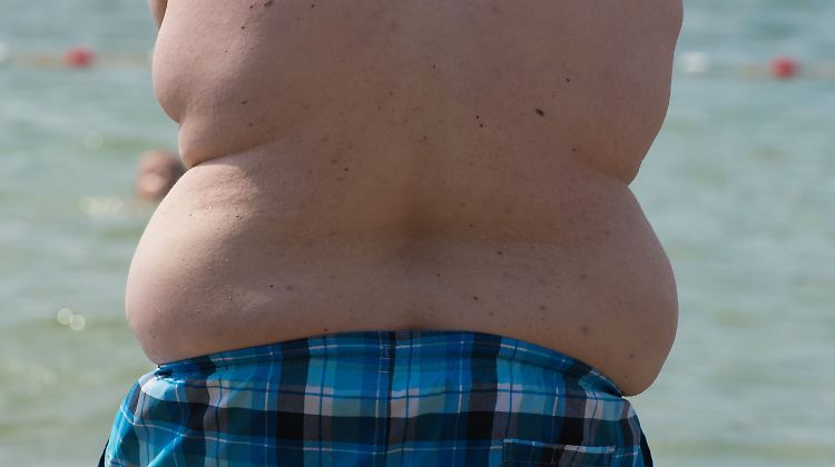 Eine magenverkleinernde OP kommt ab einem BMI von 40 infrage.