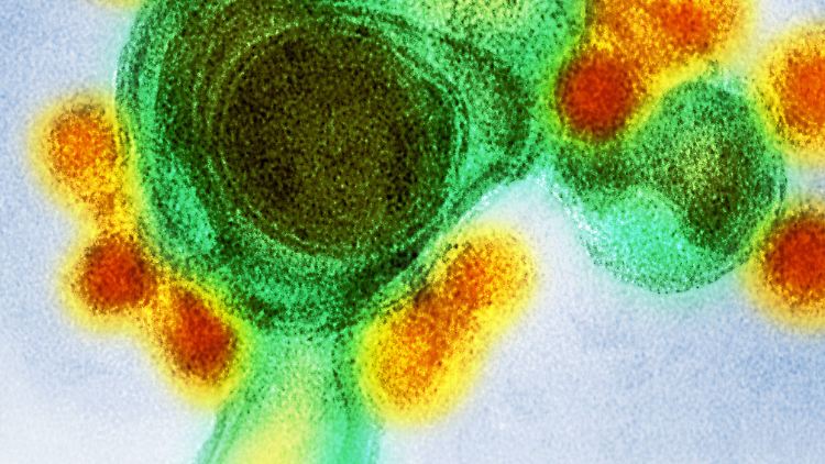 Das mikroskopische Bild des Zika-Virus.