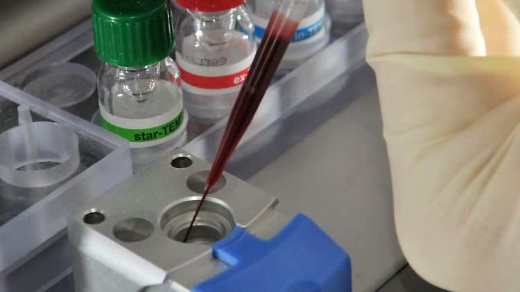 In einem Labor am Universitätsklinikum Jena wird eine Blutprobe für einen Gerinnungstest vorbereitet.
