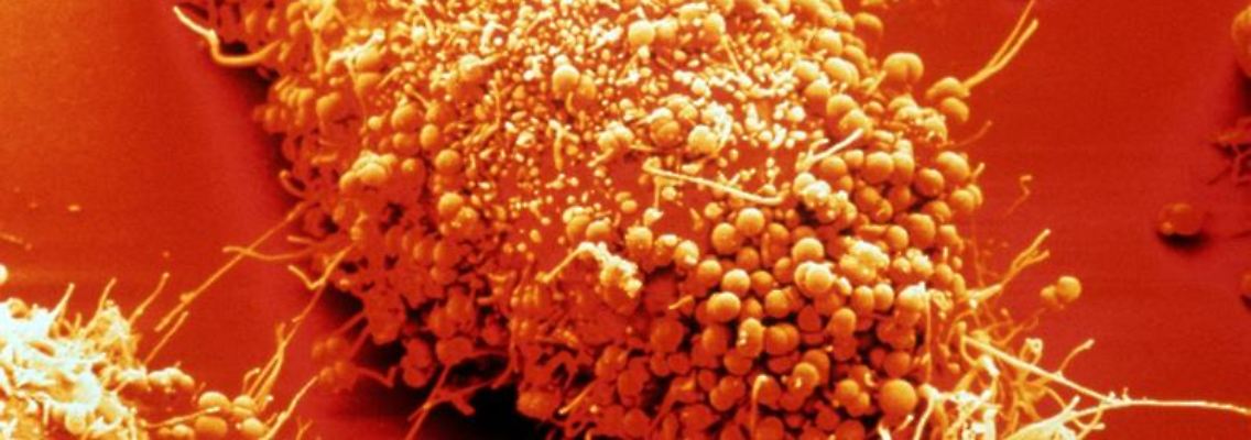 Neisserien, die Erreger der Gonorrhoe (Tripper), unter dem Mikroskop: Sie haben sich an die Oberfläche einer Epithelzelle angeheftet und sind im Begriff, in die Zelle einzudringen. Foto: Max-Planck-Gesellschaft Pressebild
