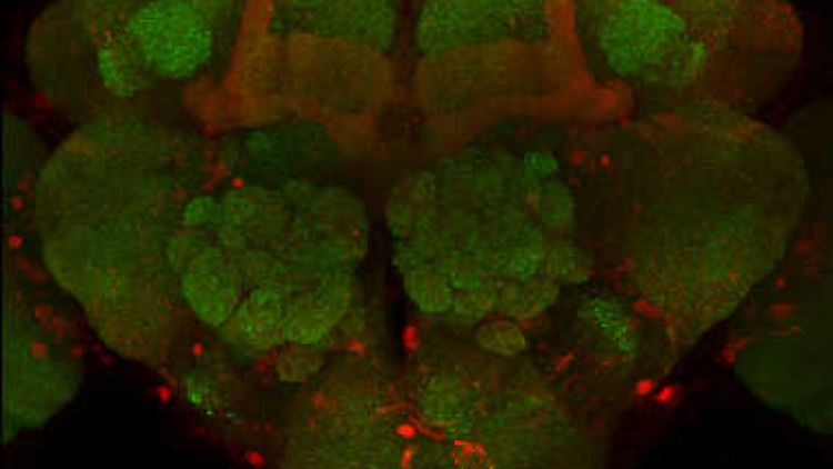 Mikroskopische Fluoreszenz-Aufnahme eines Drosophila-Gehirns von gealterten Fliegen, welche an Morbus Parkinson leiden. Es sind sowohl synaptische Verbindungen zwischen den Nervenzellen (grün) als auch die krankheitsauslösenden Proteine (rot) sichtbar.