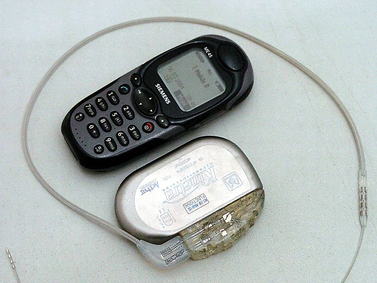 Ein Vorgänger des Hrinschrittmachers von 2004 ist noch wesentlich größer.