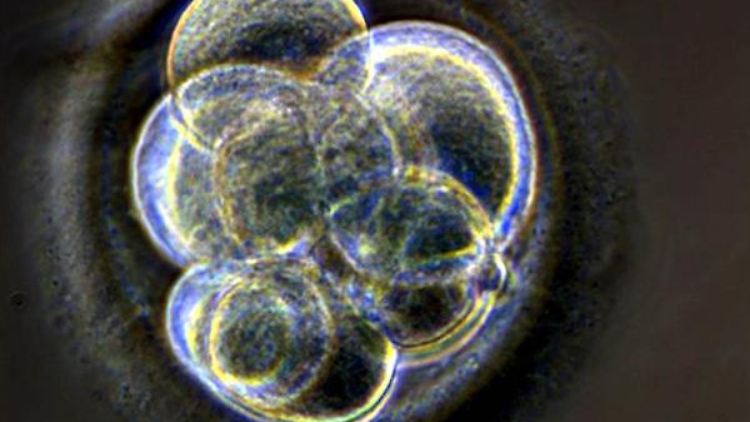 2005 klonen Forscher in Newcastle einen menschlichen Embryo aus einer Stammzelle.