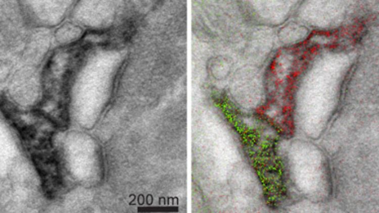 In der herkömmlichen elektronenmikroskopische Aufnahme (l.) ist es schwierig, Form und Funktion von zwei hippocampalen Astrozyten zu unterscheiden. Die rechte Aufnahme markiert die zwei Astrozyten farblich - grün für Cer und rot für Praseodym.