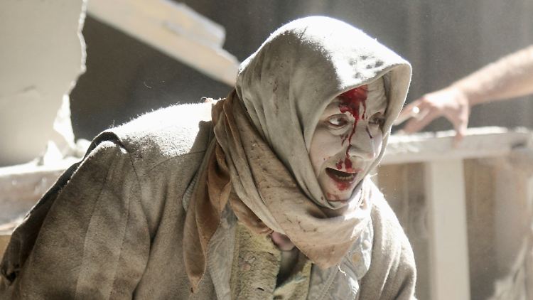 Diese Frau wurde bei einem Luftangriff in Ost-Aleppo verletzt.