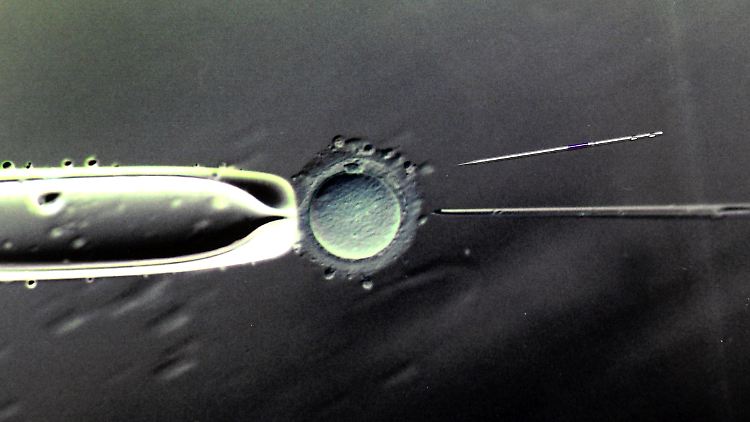 Vor der künstlichen Befruchtung wird die Eizelle der Mutter mithilfe von Mitochondrien einer anderen Frau verändert.