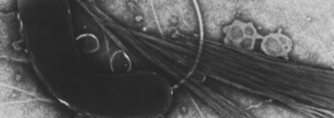 Vibrio cholerae.