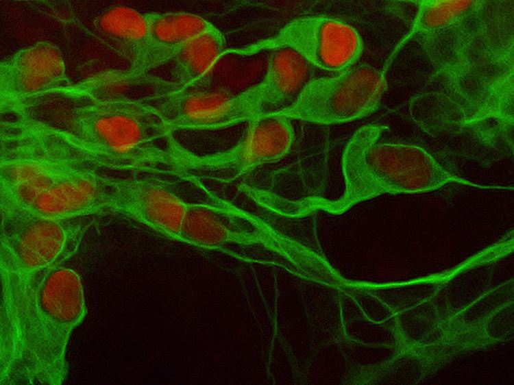 Eine mikroskopische Aufnahme maßgeschneiderter Nervenzellen, sogenannter Motor-Neuronen.