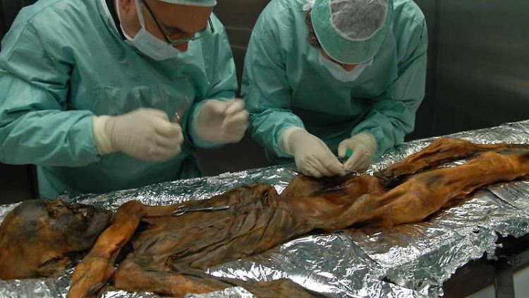 Wissenschaftler untersuchen in Bozen die 5300 Jahre alte Gletscherleiche Ötzi.