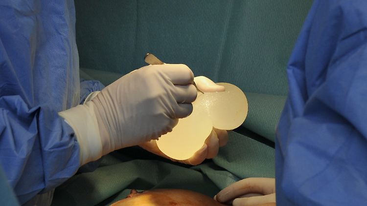 Routineoperation für Schönheitschirurgen: Die Qualität der Silikonkissen ist von großer Bedeutung.