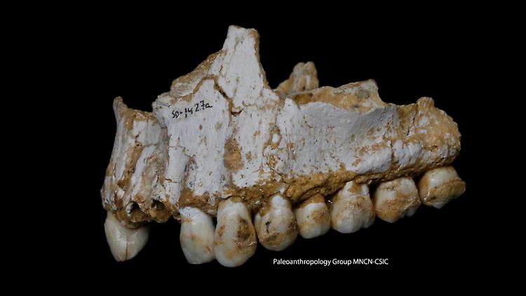 Verräterischer Zahnstein: Neandertaler nutzten Arznei-Stoffe.