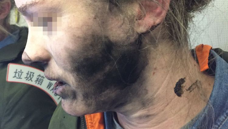 Wie sehr die Kopfhörer gequalmt haben, sieht man am verrusten Gesicht der Frau.