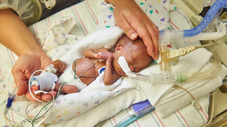 Heutzutage können schon Kinder überleben, die nach der 22. Schwangerschaftswoche zur Welt kommen.
