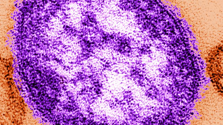 Teile eines Masernvirus.